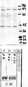 Anti-PCSK1 Rabbit Polyclonal Antibody