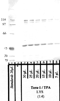 Anti-PRSS12 Rabbit Polyclonal Antibody