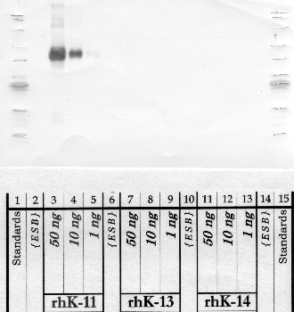 Anti-KLK11 Rabbit Polyclonal Antibody