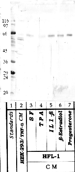 Anti-HTRA3 Rabbit Polyclonal Antibody