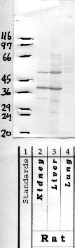 Anti-HPN Rabbit Polyclonal Antibody