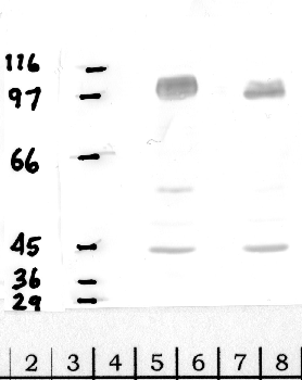 Anti-DPP8 Rabbit Polyclonal Antibody
