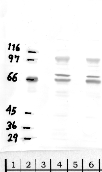 Anti-DPP8 Rabbit Polyclonal Antibody