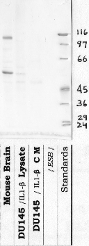 Anti-DPP6 Rabbit Polyclonal Antibody