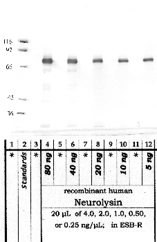 Anti-NLN Rabbit Polyclonal Antibody