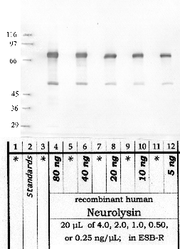 Anti-NLN Rabbit Polyclonal Antibody