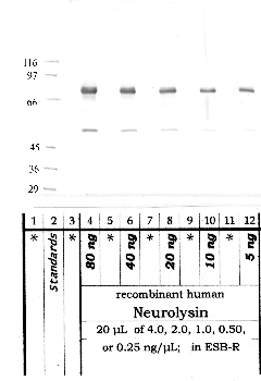 Anti-NLN Rabbit Polyclonal Antibody