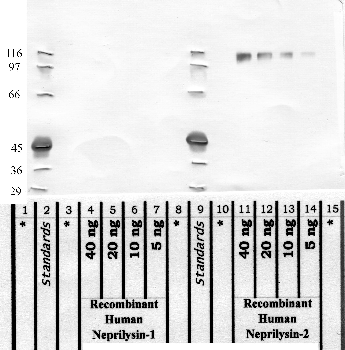 Anti-MMEL1 Rabbit Polyclonal Antibody