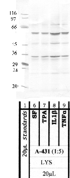 Anti-MMP25 Rabbit Polyclonal Antibody