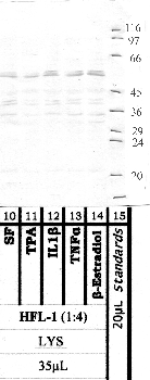 Anti-MMP17 Rabbit Polyclonal Antibody