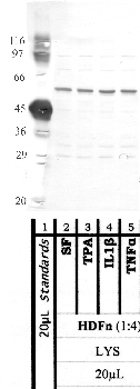 Anti-MMP17 Rabbit Polyclonal Antibody