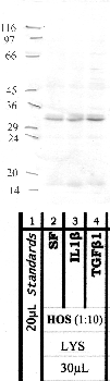 Anti-MMP16 Rabbit Polyclonal Antibody