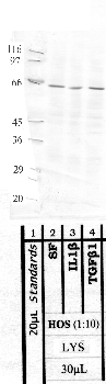 Anti-MMP8 Rabbit Polyclonal Antibody