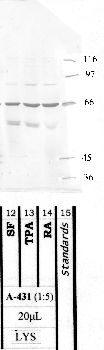 Anti-LMLN Rabbit Polyclonal Antibody