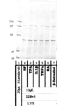 Anti-ADAMTS17 Rabbit Polyclonal Antibody