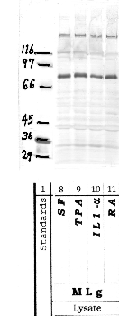 Anti-ADAMTS16 Rabbit Polyclonal Antibody