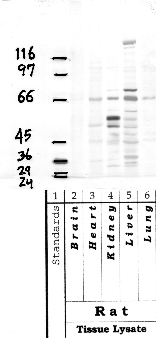 Anti-ADAMTS15 Rabbit Polyclonal Antibody