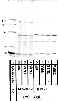Anti-ADAMTS12 Rabbit Polyclonal Antibody