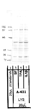 Anti-ADAMTS8 Rabbit Polyclonal Antibody
