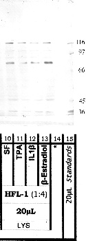 Anti-ADAMTS7 Rabbit Polyclonal Antibody