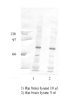 Anti-ADAM22 Rabbit Polyclonal Antibody