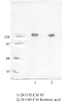 Anti-ADAM22 Rabbit Polyclonal Antibody