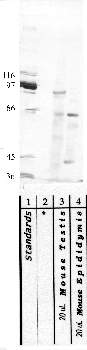 Anti-ADAM21 Rabbit Polyclonal Antibody