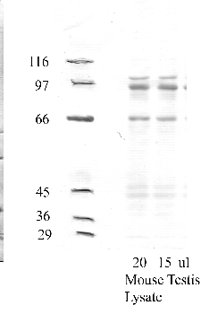 Anti-ADAM20 Rabbit Polyclonal Antibody