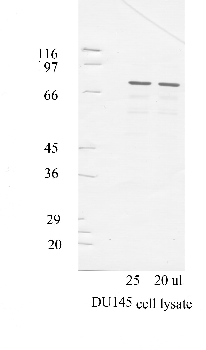 Anti-ADAM11 Rabbit Polyclonal Antibody