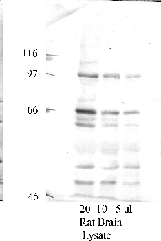 Anti-ADAM11 Rabbit Polyclonal Antibody
