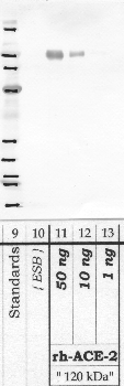 Anti-ACE2 Rabbit Polyclonal Antibody