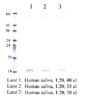 Anti-CSTF Rabbit Polyclonal Antibody
