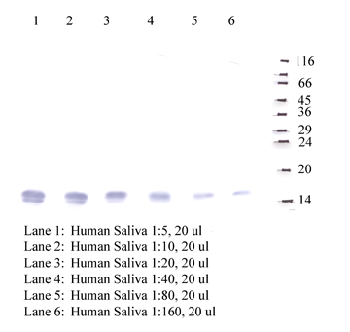 Anti-CSTA Rabbit Polyclonal Antibody