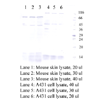 Anti-CSTA Rabbit Polyclonal Antibody