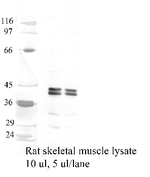 Anti-CTSO Rabbit Polyclonal Antibody