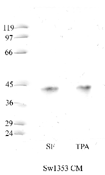 Anti-CTSL Rabbit Polyclonal Antibody