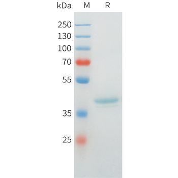 Mouse MMP13 Protein, His Tag