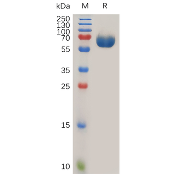 Human IL20 Protein, hFc Tag