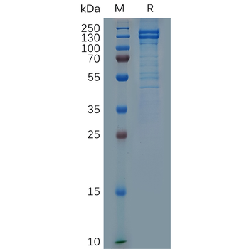 Human FN1 Protein, His Tag