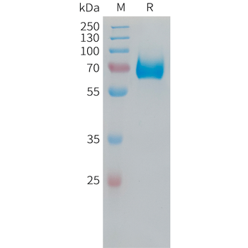 Human B4GALT1 Protein, hFc Tag