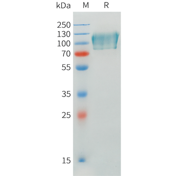 Mouse LAMA4 Protein, His Tag