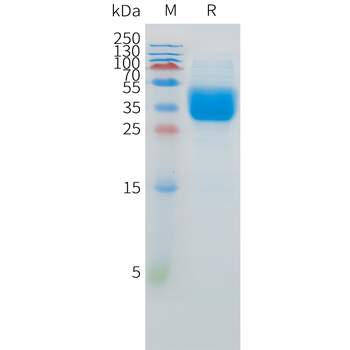 Mouse ADAM9 Protein, His Tag