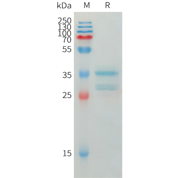Cynomolgus CXCL10 Protein, hFc Tag