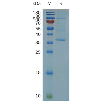 Human CD32a (R167) Protein, hFc Tag