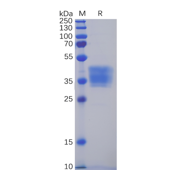 Human NRG1 Protein, hFc Tag