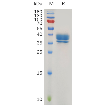 Human CCR8 Protein, hFc Tag