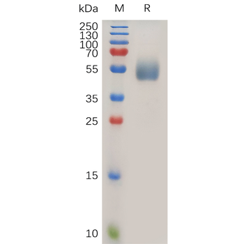 Human IL18RA Protein, hFc Tag