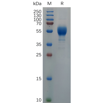 Human GM-CSFR Protein, hFc Tag