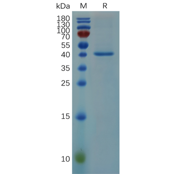 Human IL1RA Protein, hFc Tag