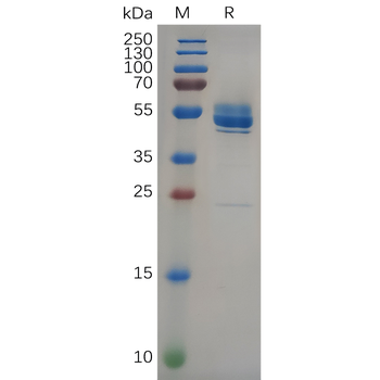 Human IL1B Protein, hFc Tag